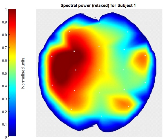 Brain topographic map